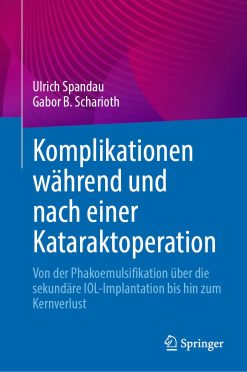 Komplikationen während und nach einer Kataraktoperation (Original PDF from Publisher)