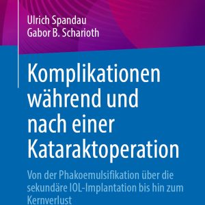 Komplikationen während und nach einer Kataraktoperation (EPUB)