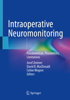 Intraoperative Neuromonitoring (EPUB)