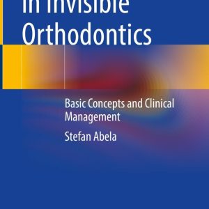 Aligner Systems in Invisible Orthodontics: Basic Concepts and Clinical Management (EPUB)