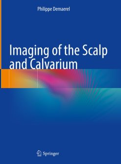Imaging of the Scalp and Calvarium (EPUB)