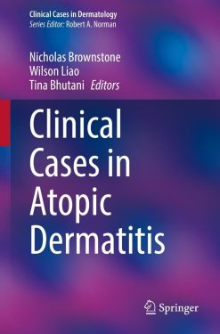 Clinical Cases in Atopic Dermatitis (EPUB)