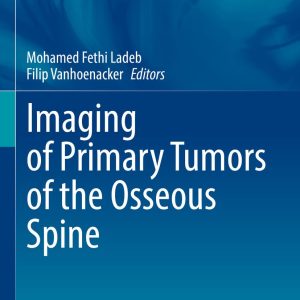 Imaging of Primary Tumors of the Osseous Spine (Original PDF from Publisher)