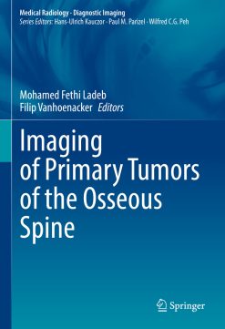Imaging of Primary Tumors of the Osseous Spine (EPUB)