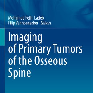 Imaging of Primary Tumors of the Osseous Spine (EPUB)