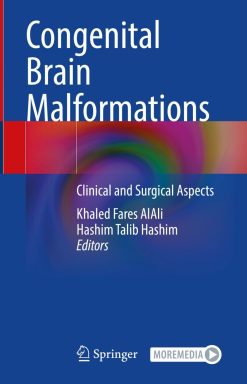 Congenital Brain Malformations: Clinical and Surgical Aspects (Original PDF from Publisher)