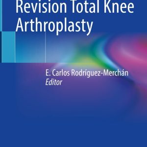 Advances in Revision Total Knee Arthroplasty (EPUB)