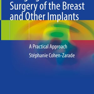Imaging of Plastic Surgery of the Breast and Other Implants (EPUB)