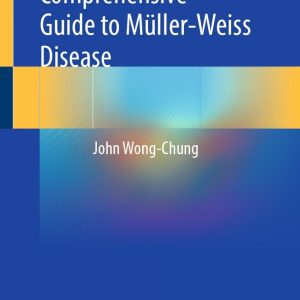 Comprehensive Guide to Müller-Weiss Disease (Original PDF from Publisher)