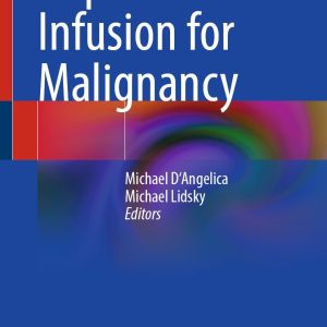 Hepatic Arterial Infusion for Malignancy (Original PDF from Publisher)