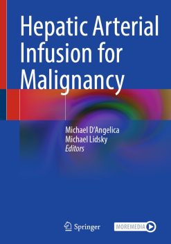 Hepatic Arterial Infusion for Malignancy (EPUB)