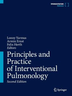 Principles and Practice of Interventional Pulmonology, 2026th Edition (EPUB)