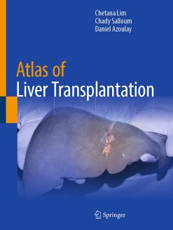 Atlas of Liver Transplantation (EPUB)