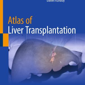 Atlas of Liver Transplantation (EPUB)