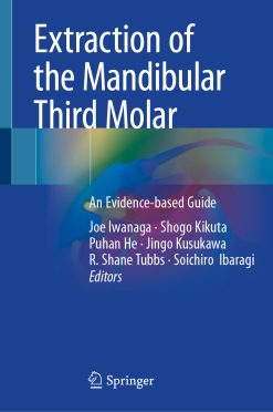 Extraction of the Mandibular Third Molar: An Evidence-based Guide (EPUB)