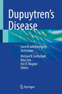 Dupuytren’s Disease: Current and Emerging Techniques (Original PDF from Publisher)