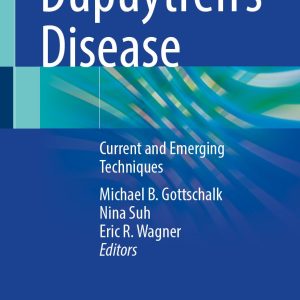 Dupuytren’s Disease: Current and Emerging Techniques (Original PDF from Publisher)