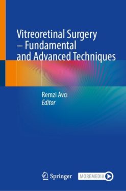 Vitreoretinal Surgery – Fundamental and Advanced Techniques (EPUB)