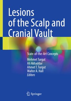 Lesions of the Scalp and Cranial Vault: State-of-the-Art Concepts (Original PDF from Publisher)
