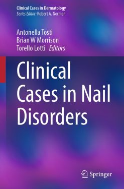 Clinical Cases in Nail Disorders (EPUB)