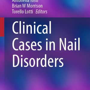 Clinical Cases in Nail Disorders (EPUB)