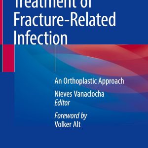 Treatment of Fracture-Related Infection: An Orthoplastic Approach (EPUB)