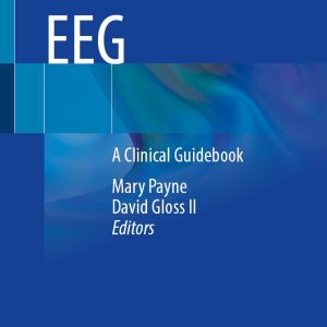 Neonatal EEG: A Clinical Guidebook (Original PDF from Publisher)