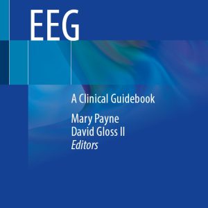 Neonatal EEG: A Clinical Guidebook (EPUB)