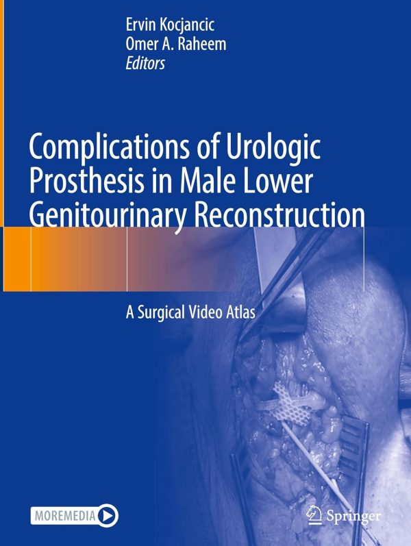 Complications of Urologic Prosthesis in Male Lower Genitourinary Reconstruction: A Surgical Video Atlas (EPUB)