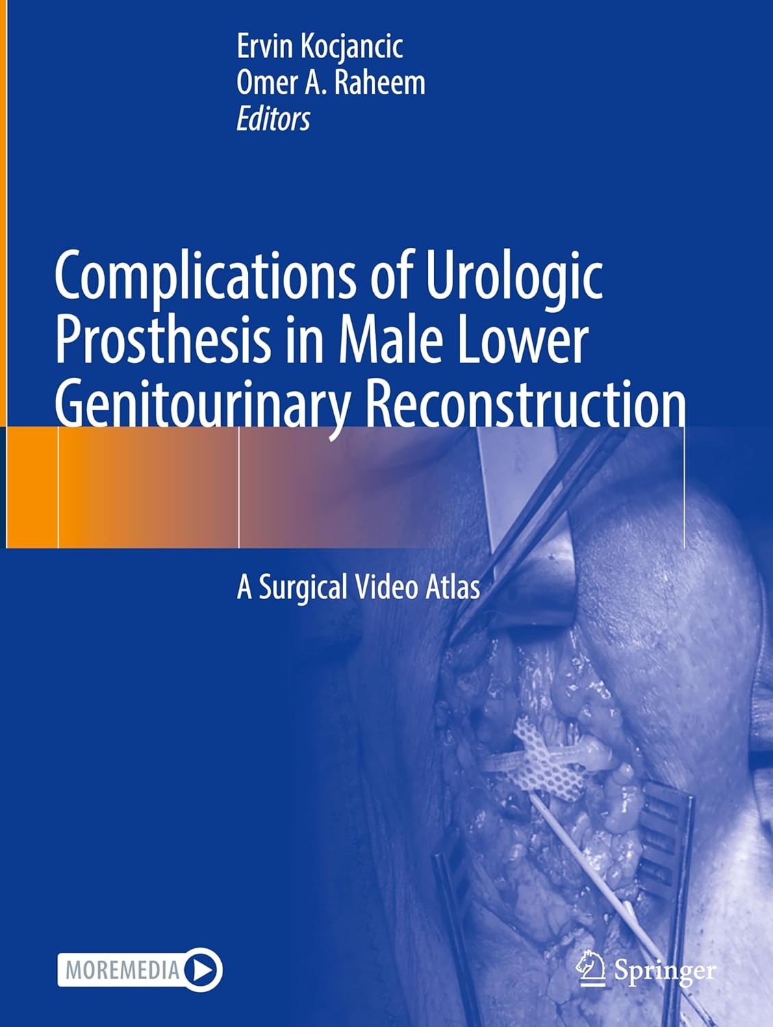 Complications of Urologic Prosthesis in Male Lower Genitourinary Reconstruction: A Surgical Video Atlas (EPUB)