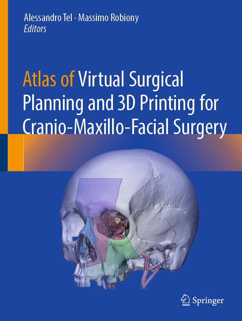 Atlas of Virtual Surgical Planning and 3D Printing for Cranio-Maxillo-Facial Surgery (EPUB)