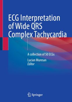 ECG Interpretation of Wide QRS Complex Tachycardia: A collection of 50 ECGs (EPUB)
