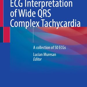 ECG Interpretation of Wide QRS Complex Tachycardia: A collection of 50 ECGs (EPUB)