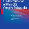 ECG Interpretation of Wide QRS Complex Tachycardia: A collection of 50 ECGs (Original PDF from Publisher)