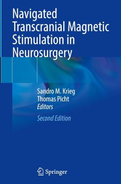Navigated Transcranial Magnetic Stimulation in Neurosurgery, 2025th Edition (Original PDF from Publisher)