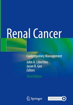 Renal Cancer: Contemporary Management, 2025th Edition (Original PDF from Publisher)