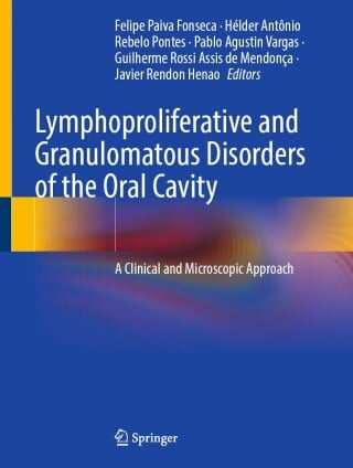 Lymphoproliferative and Granulomatous Disorders of the Oral Cavity (Original PDF from Publisher)