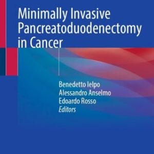 Minimally Invasive Pancreatoduodenectomy in Cancer (EPUB)