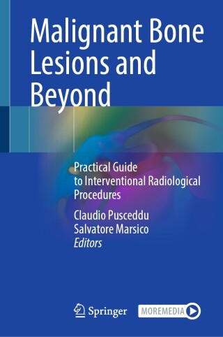 Malignant Bone Lesions and Beyond (EPUB)