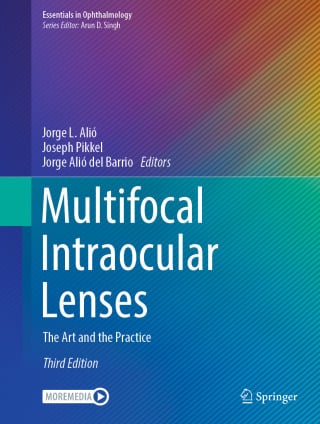 Multifocal Intraocular Lenses, 2026th Edition (EPUB)