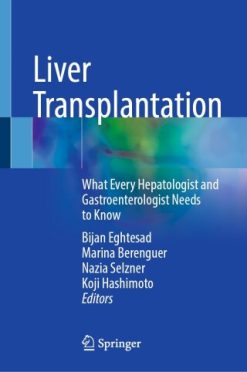 Liver Transplantation (Original PDF from Publisher)