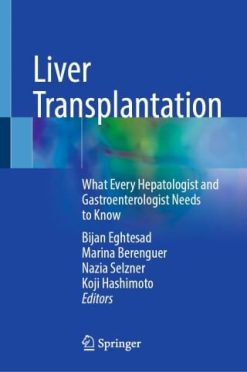 Liver Transplantation (EPUB)