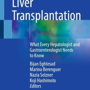 Liver Transplantation (EPUB)
