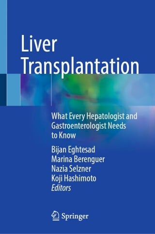 Liver Transplantation (EPUB)