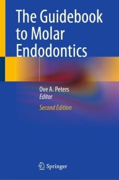 The Guidebook to Molar Endodontics, 2nd Edition (EPUB)