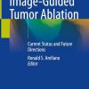 Image-Guided Tumor Ablation: Current Status and Future Directions (Original PDF from Publisher)