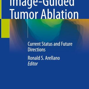Image-Guided Tumor Ablation: Current Status and Future Directions (Original PDF from Publisher)