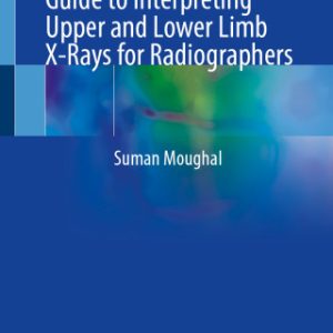 Fracture Finder: A Practical Guide to Interpreting Upper and Lower Limb X-Rays for Radiographers (Original PDF from Publisher)