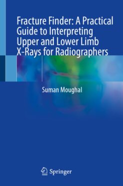 Fracture Finder: A Practical Guide to Interpreting Upper and Lower Limb X-Rays for Radiographers (EPUB)