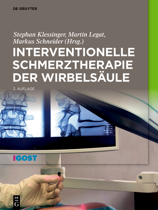 Interventionelle Schmerztherapie der Wirbelsäule (2nd ed.) (EPUB)